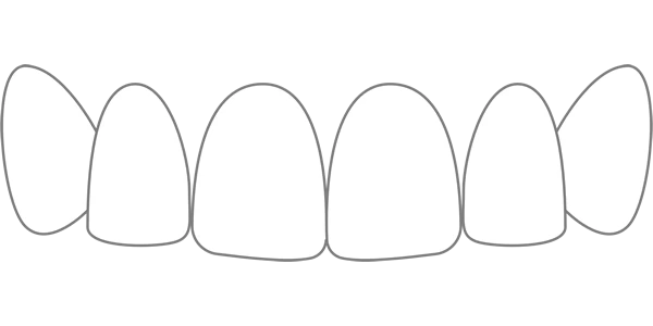 Level 1 Smile Scale.png