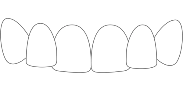 Level 2 Smile Scale.png